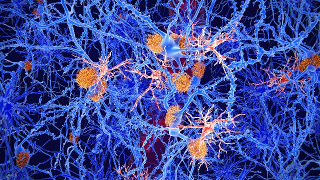 Fighting Neurodegeneration by Understanding Inflammation