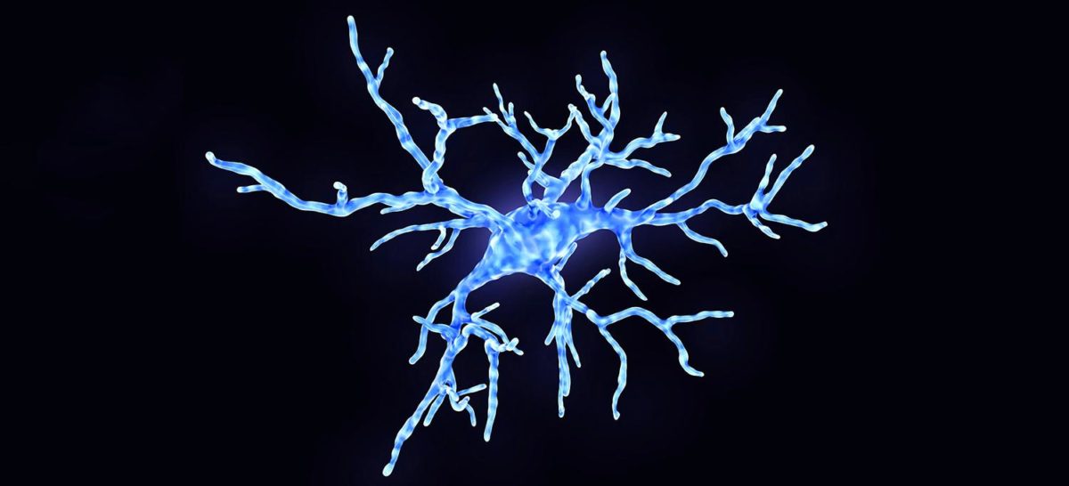 Gene Mutation May Explain Brain Cell Plaque Buildup in Alzheimer’s Disease