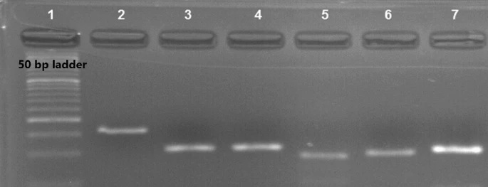 Expression analysis of NF-ƙB-related long non-coding RNAs in bipolar disorder