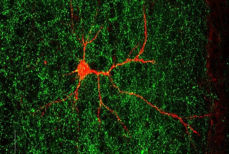 Autism-Linked Gene Found to Shape Nerve Connections