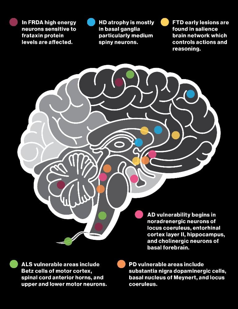 Study Traces Shared and Unique Cellular Hallmarks Found in 6 Neurodegenerative Diseases