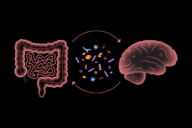 Microbiota Transfer Therapy Provides Long Term Improvement in Gut Health in Children With Autism