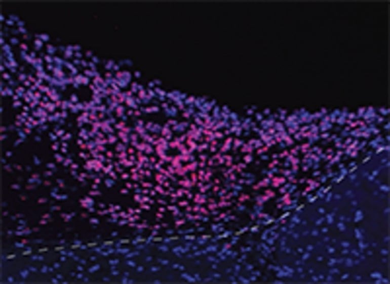 Human Brain Organoids Implanted Into Mouse Cortex Respond to Visual Stimuli for First Time