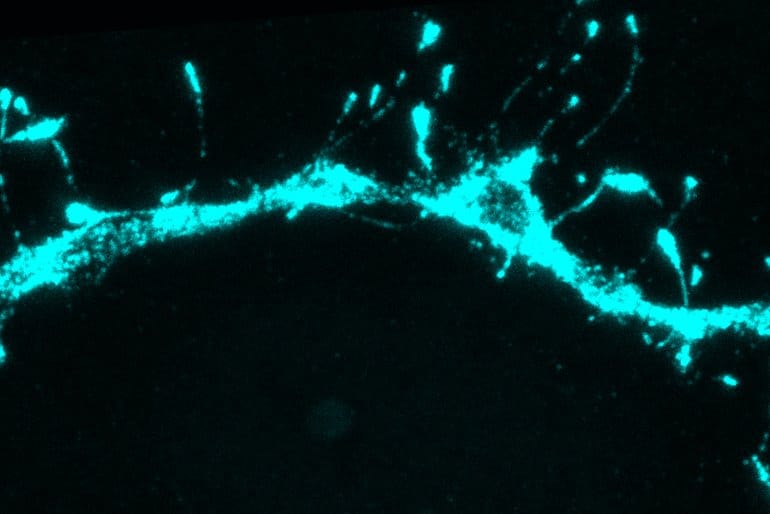 Silent Synapses Are Abundant in the Adult Brain