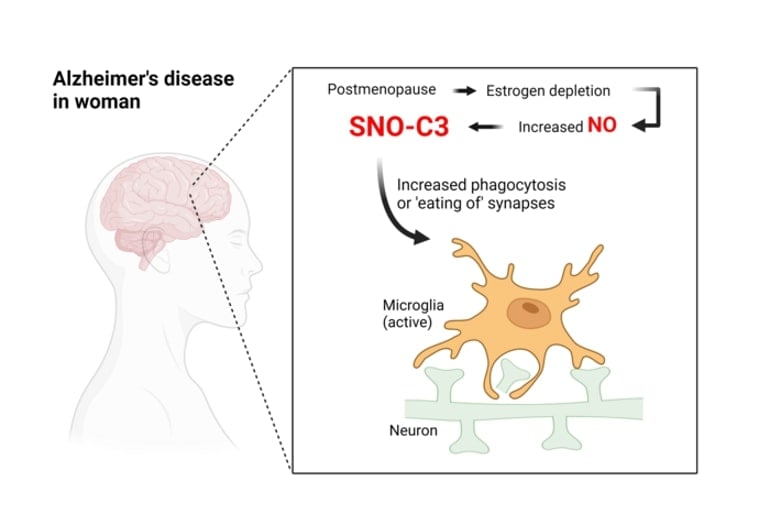 Discovery Could Explain Why Women Are More Likely to Get Alzheimer’s