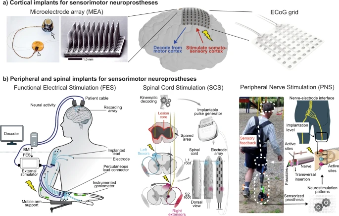 Neuroprosthetics: from sensorimotor to cognitive disorders