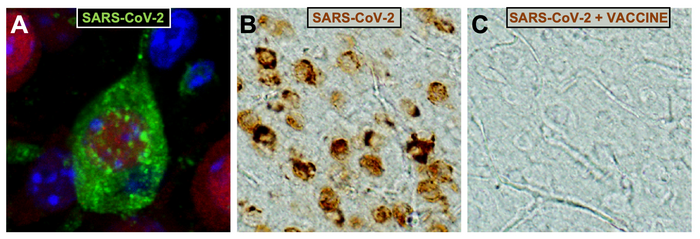 A CSIC vaccine against COVID-19 protects against infection and brain damage caused by the virus