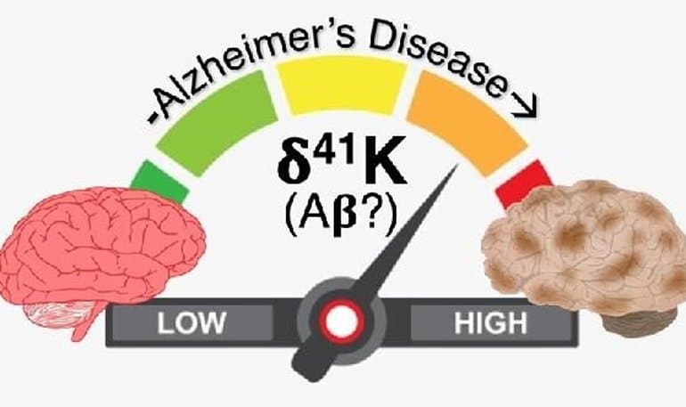 Accumulation of Amyloid Beta Protein at Sites of Potassium Depletion in the Brain Discovered