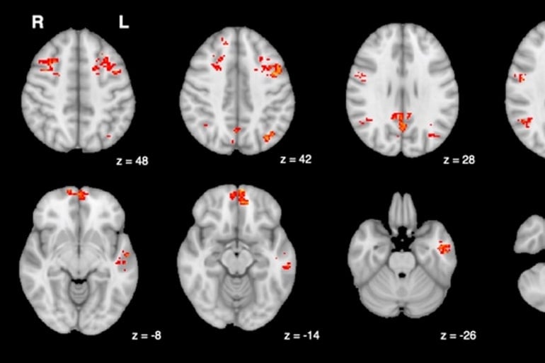 Even Brief Exposure to Air Pollution Has Rapid Impacts on the Brain