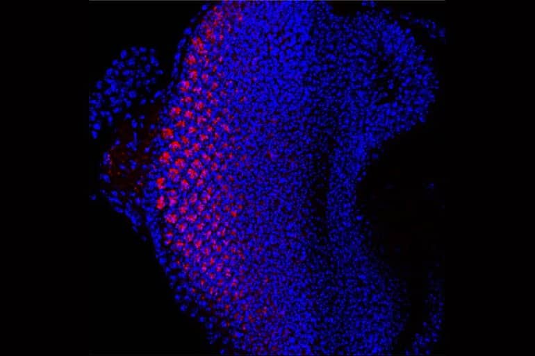 Fruit Flies Help Researchers Decode Genetic Link to Alzheimer’s Disease