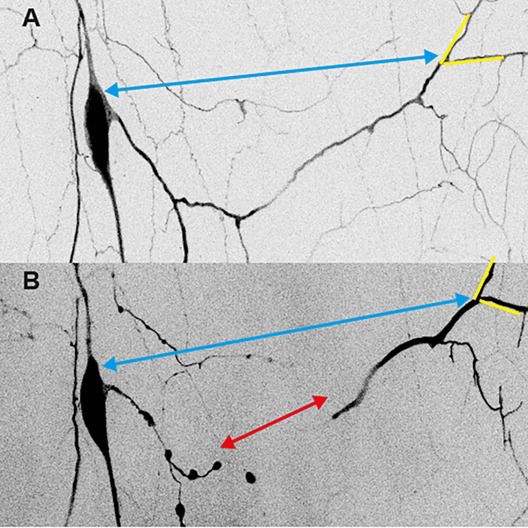 Mechanical Forces in the Nervous System Play a Corrective Role