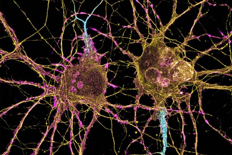 How Huntington’s Disease Affects Different Neurons