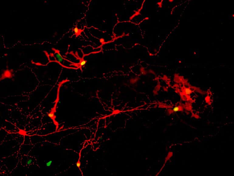 Lab-Grown Retinal Cells Open the Door to Treat Blindness and Degenerative Eye Diseases