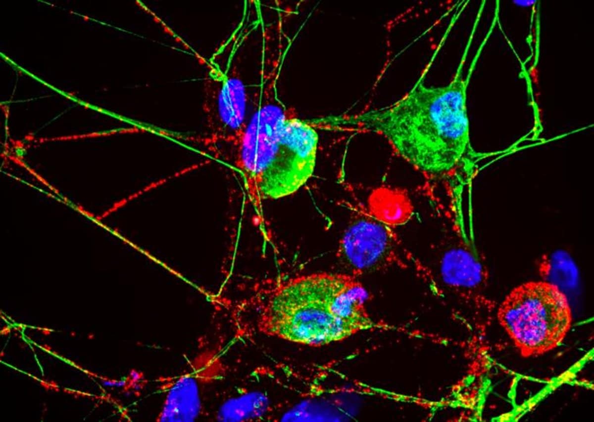 Proteasomes May Be Key to Sensory Signals