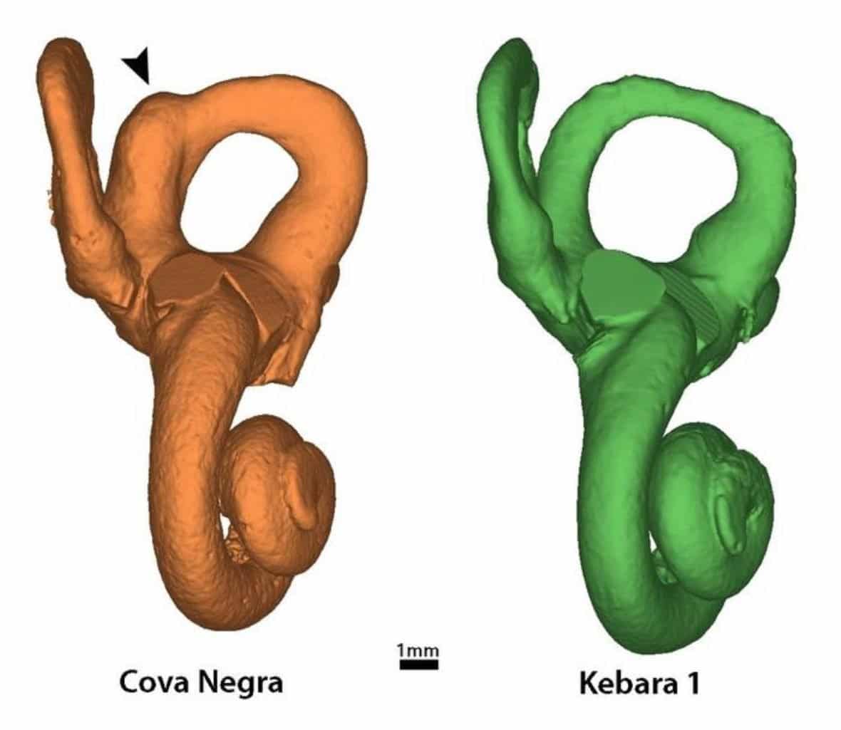 First Neandertal with Down Syndrome: Evidence of Altruistic Care in Prehistory