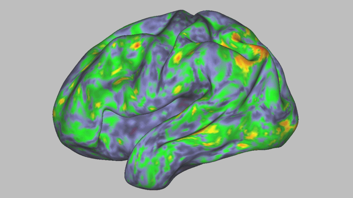 Magic mushrooms temporarily ‘dissolve’ brain network responsible for sense of self