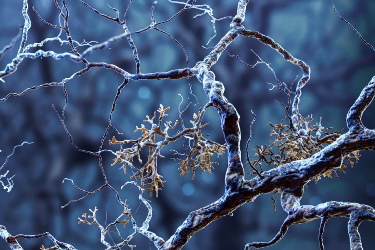 Study Reveals Structure of Alzheimer’s Molecules in Human Brain