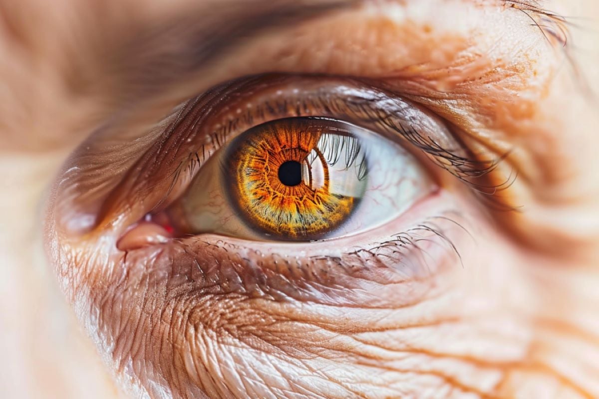 Antioxidants Slow Vision Loss in Late-Stage Dry AMD